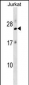 RPL18 Antibody (N-term)